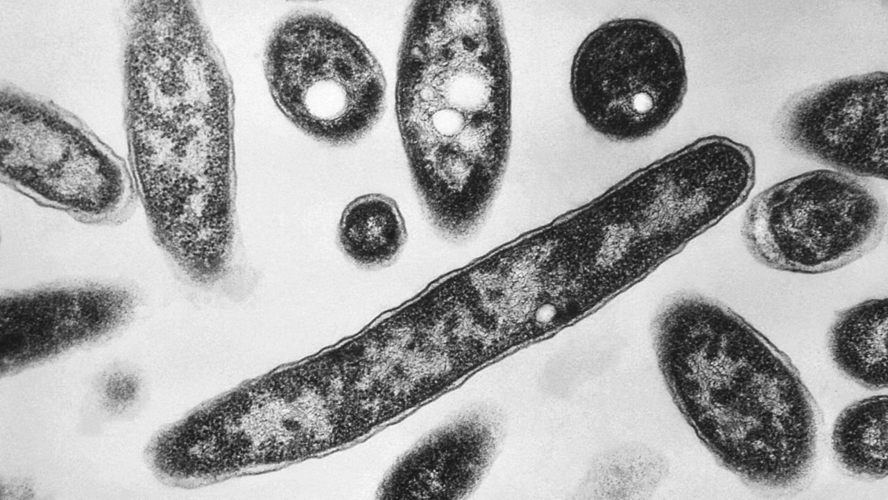 legionnaires’-disease-detected-in-brooklyn-nycha-housing-complex