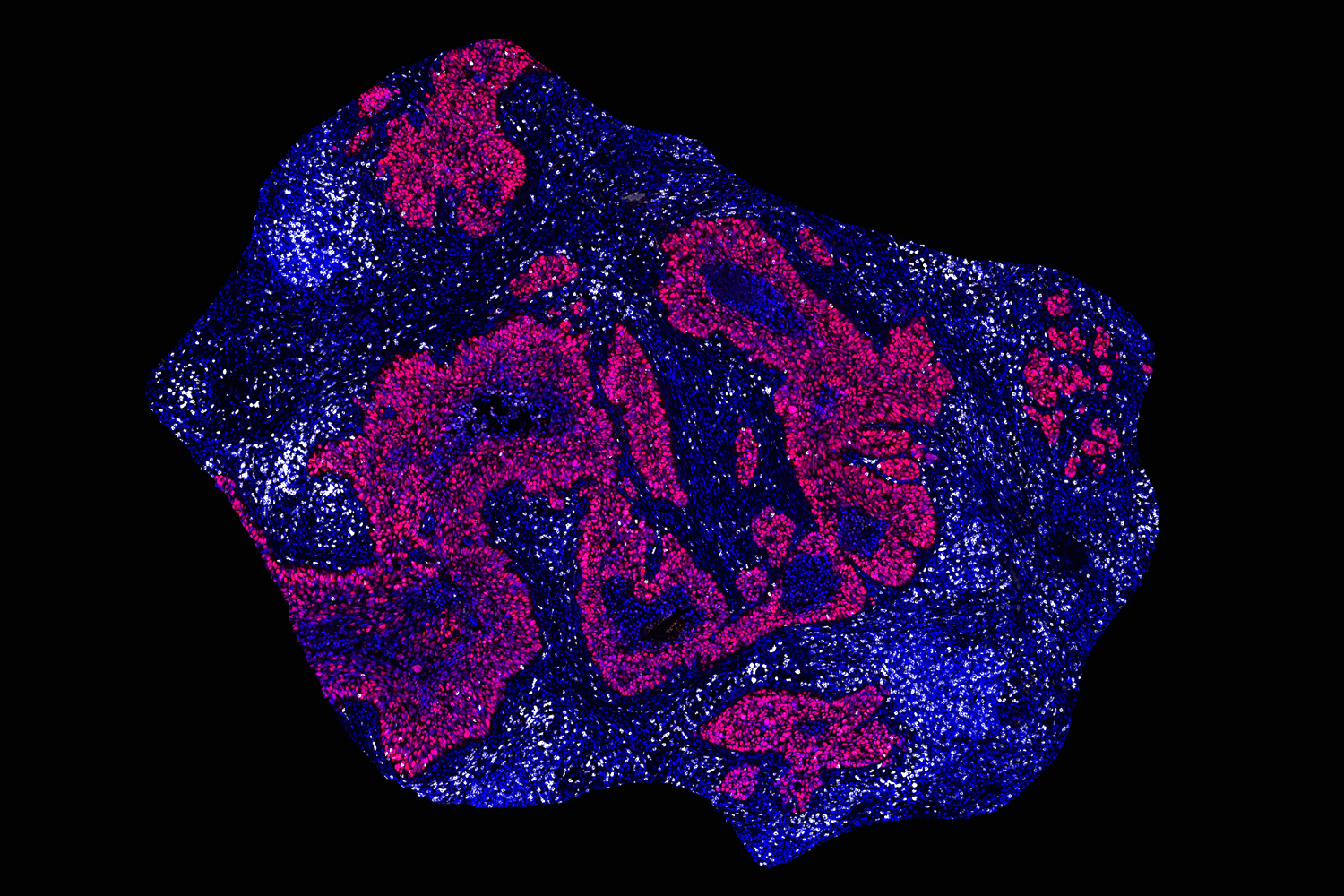 a-blueprint-for-better-cancer-immunotherapies