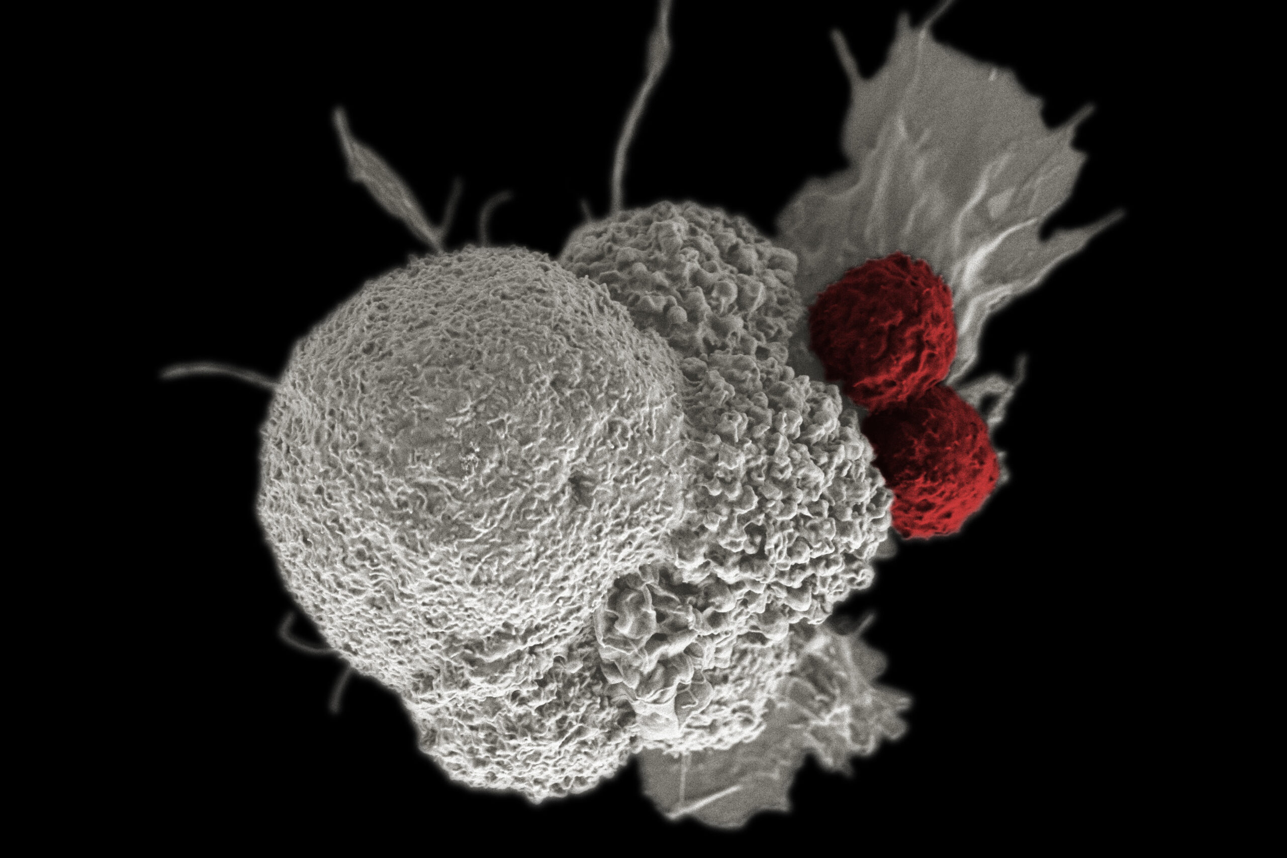 equipping-living-cells-with-logic-gates-to-fight-cancer