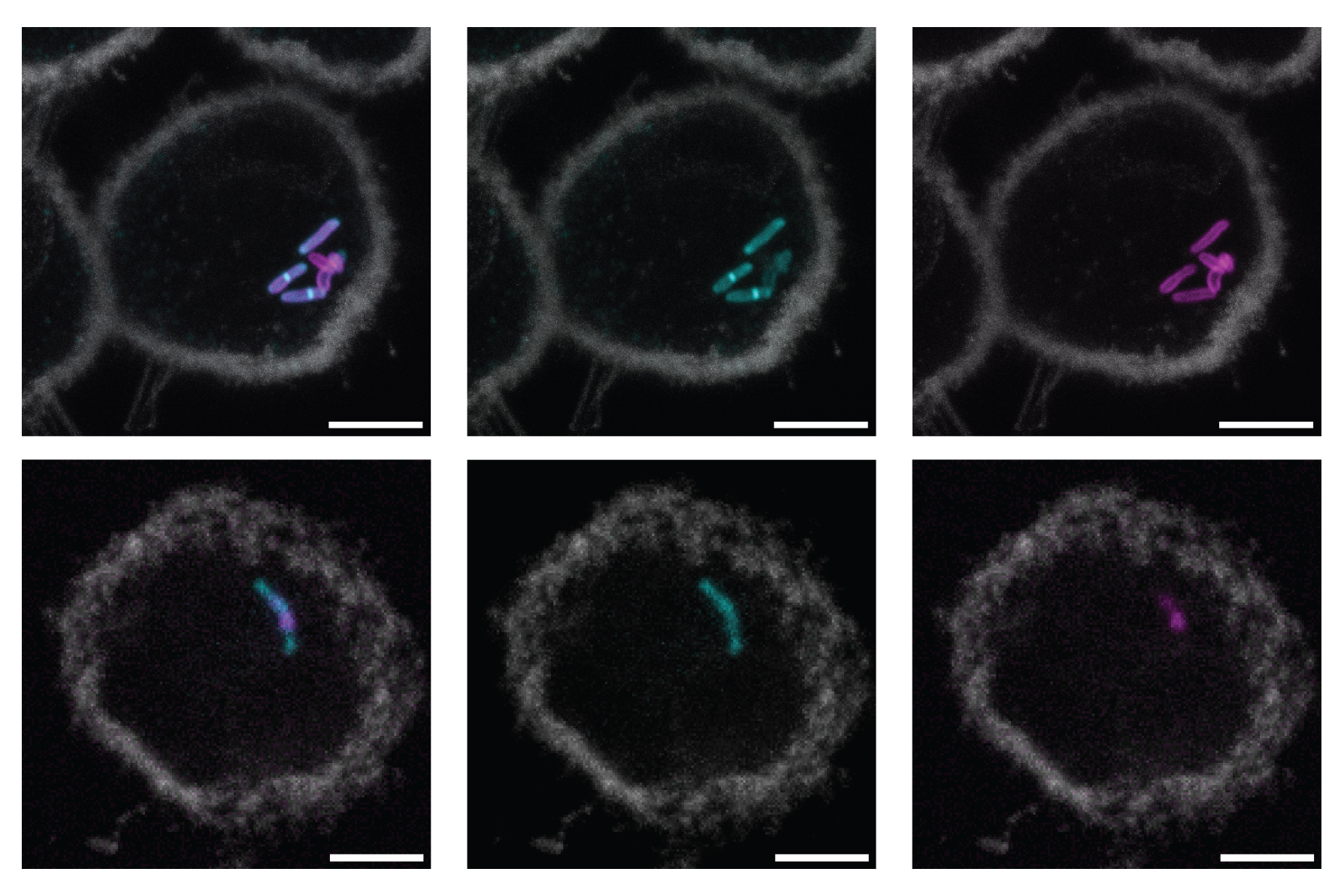 new-molecular-label-could-lead-to-simpler,-faster-tuberculosis-tests
