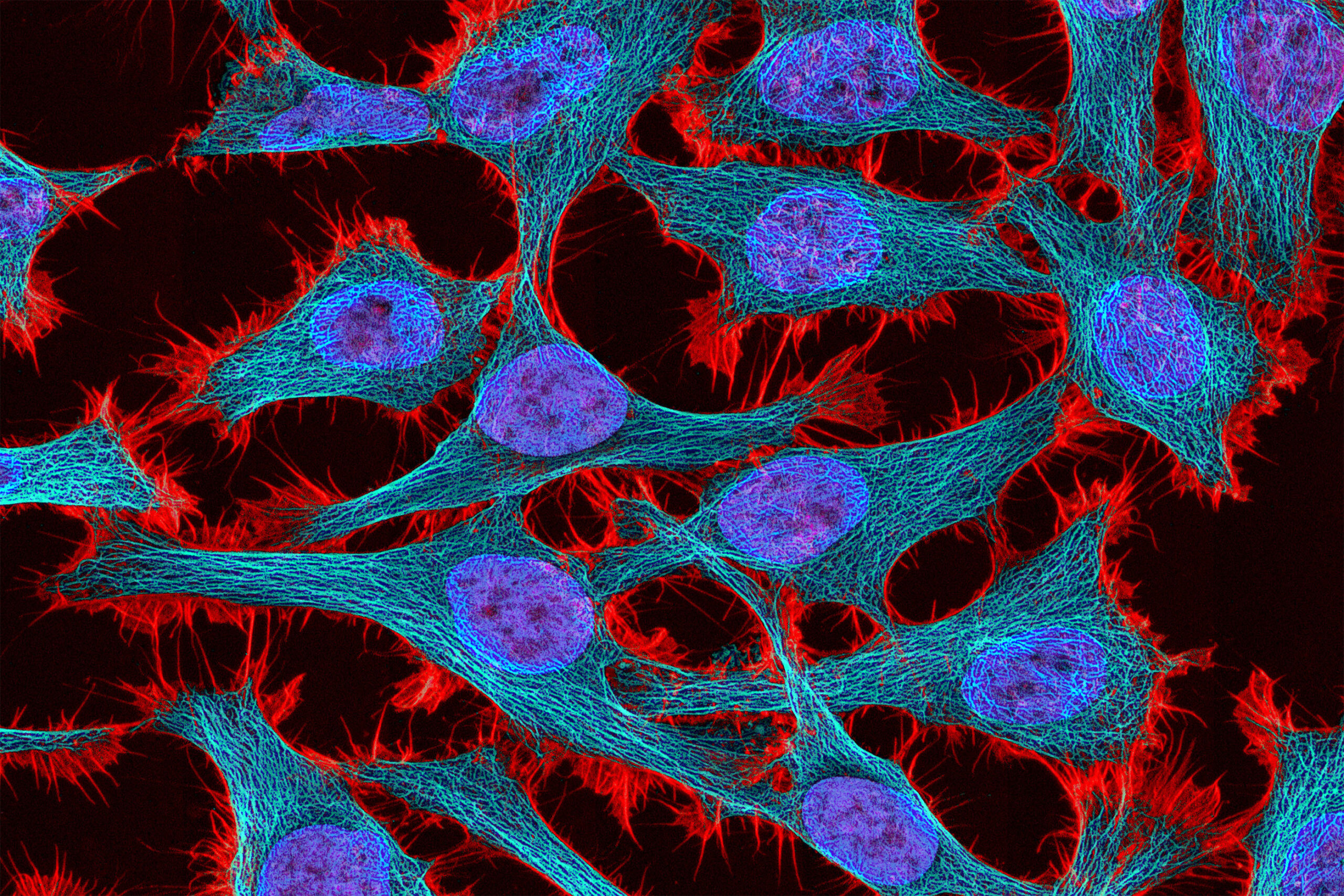 gene-circuits-enable-more-precise-control-of-gene-therapy