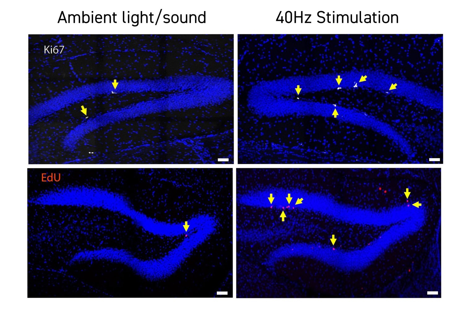 in-down-syndrome-mice,-40hz-light-and-sound-improve-cognition,-neurogenesis,-connectivity