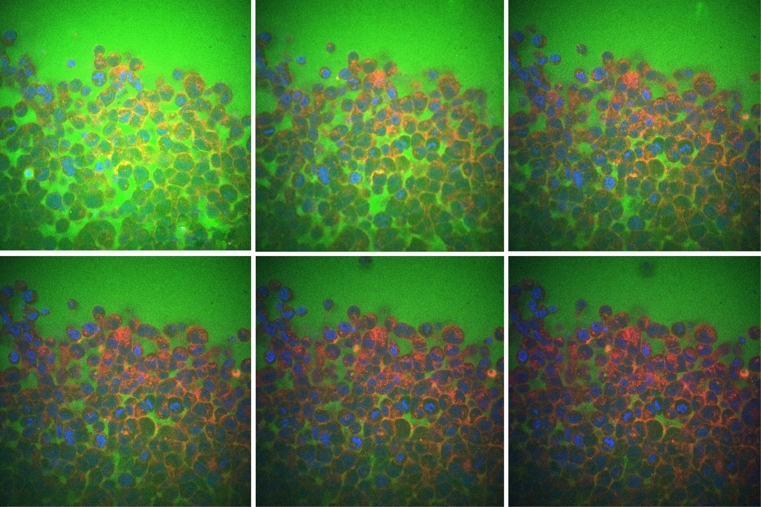 mit-engineers-uncover-a-surprising-reason-why-tissues-are-flexible-or-rigid