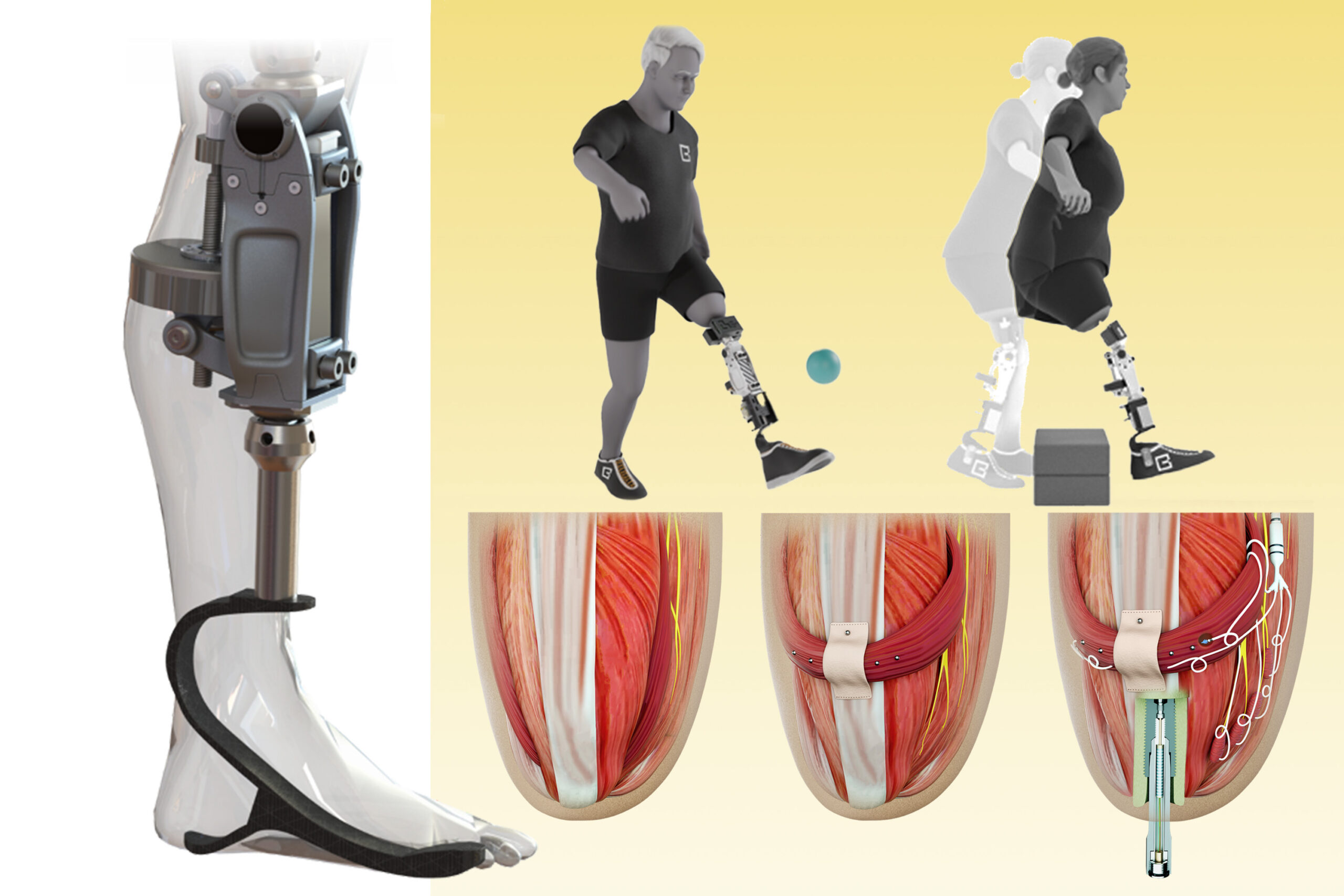 a-bionic-knee-integrated-into-tissue-can-restore-natural-movement