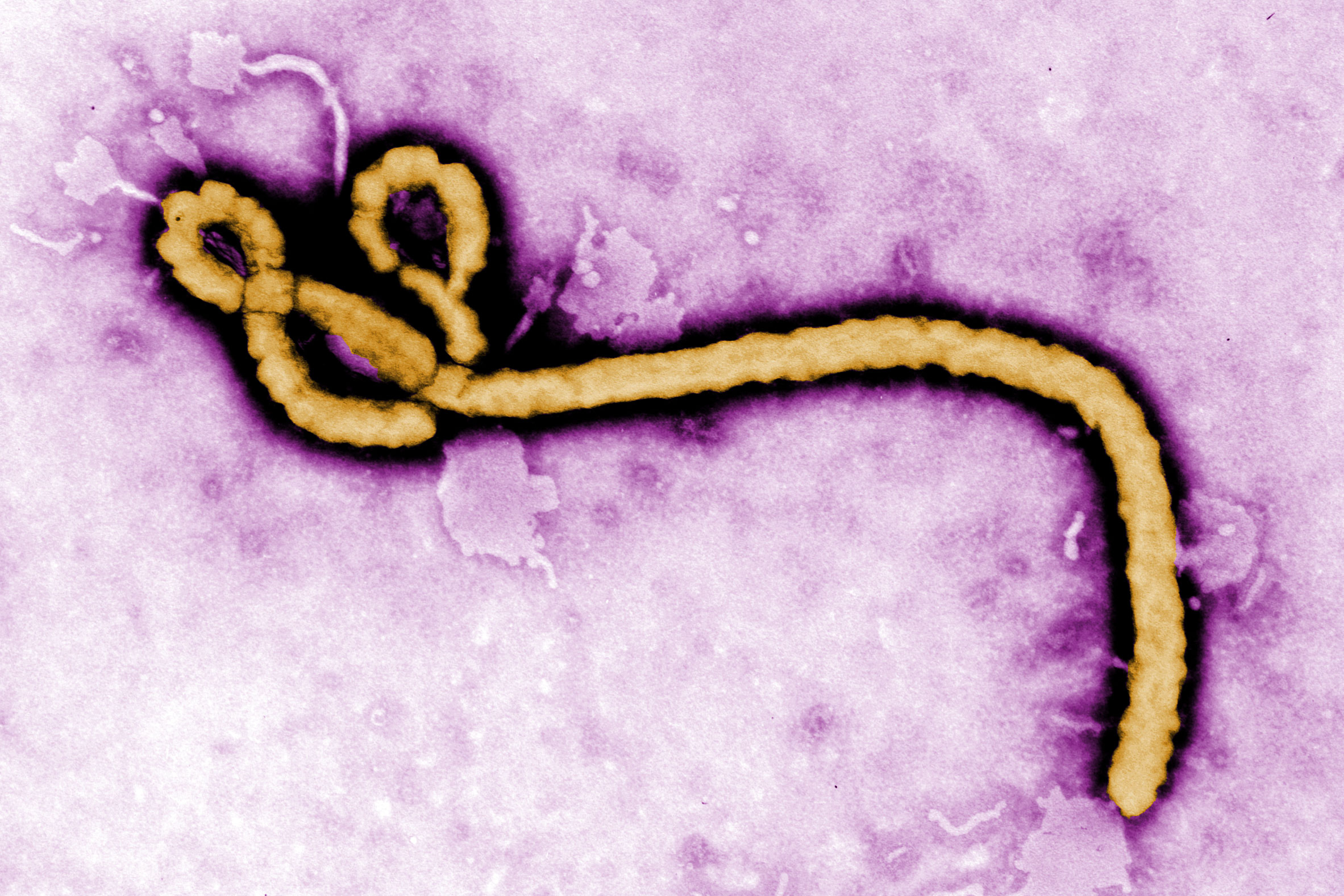 scientists-apply-optical-pooled-crispr-screening-to-identify-potential-new-ebola-drug-targets