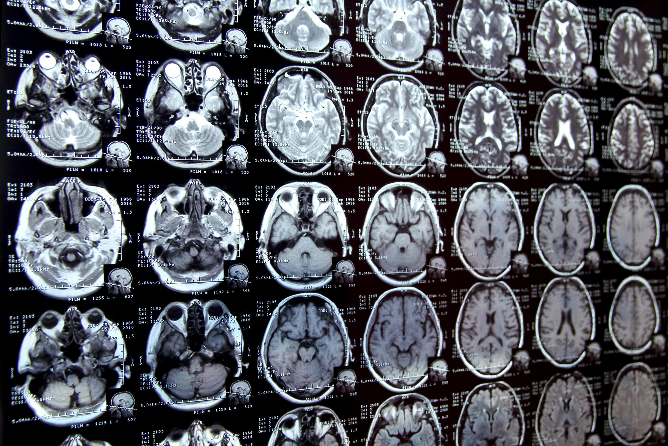 new-ai-system-could-accelerate-clinical-research