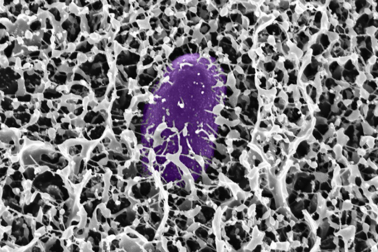 study-shows-mucus-contains-molecules-that-block-salmonella-infection
