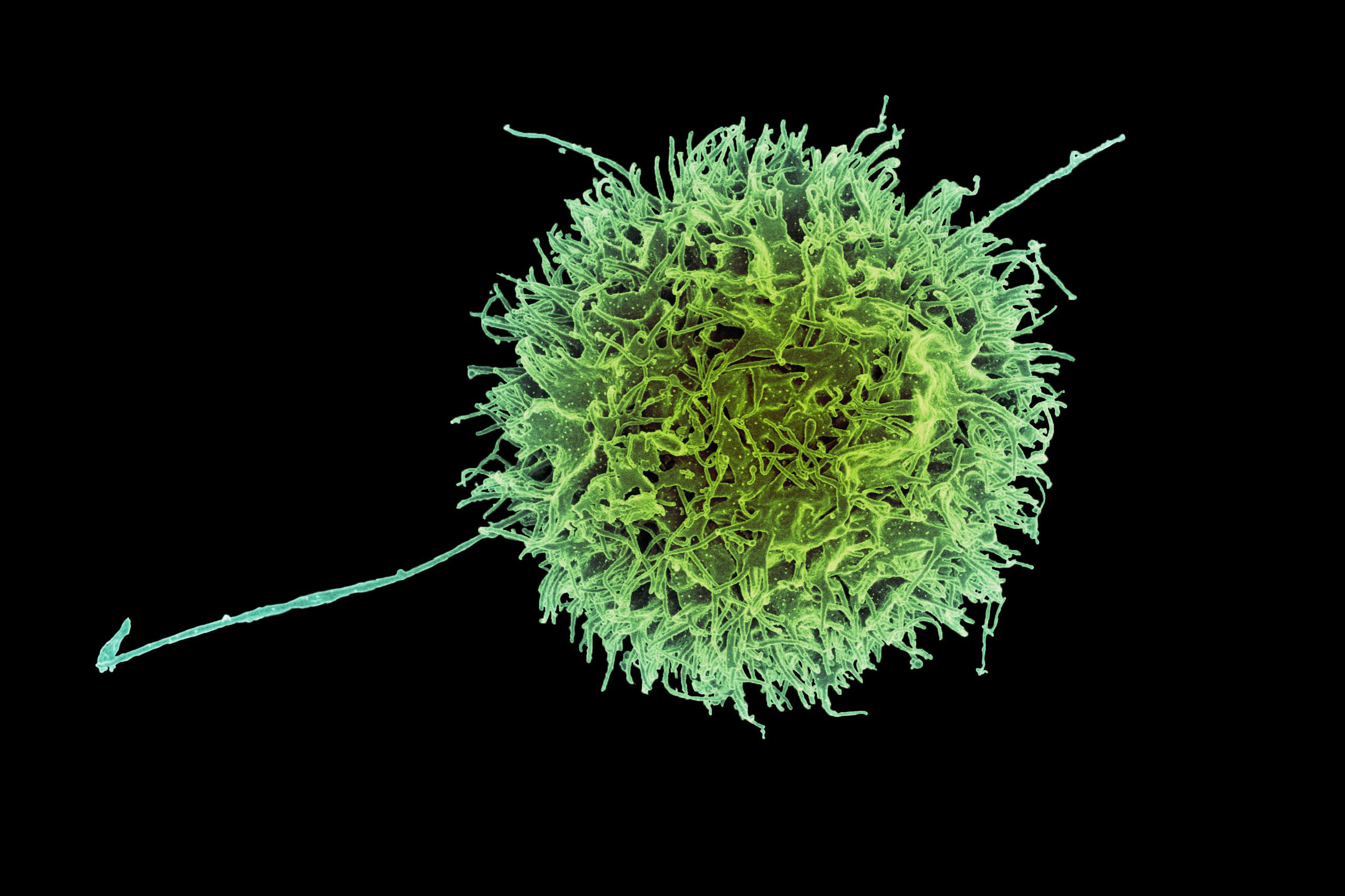 engineered-“natural-killer”-cells-could-help-fight-cancer